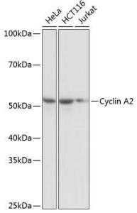 Western blot analysis of extracts of various cell lines, using Anti-Cyclin A2 Antibody [ARC0359] (A308964) at 1:1,000 dilution