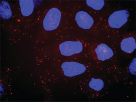 Anti-FLT1 + PIK3R1 Antibody Pair