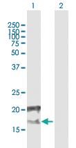 Anti-CCDC126 Mouse Polyclonal Antibody