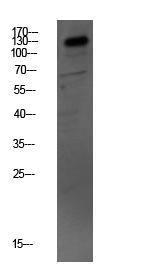 Western blot analysis of mouse kidney lysate using Anti-MYBPC3 Antibody