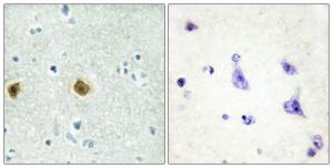 Anti-NDUC2 antibody