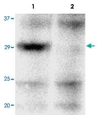 Anti-UBE2J2 Rabbit Polyclonal Antibody