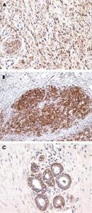 Anti-S100 A1 Rabbit Monoclonal Antibody [clone: D28-E]