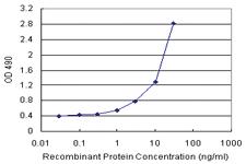 Anti-CBR3 Polyclonal Antibody Pair