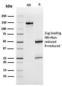 SDS-PAGE analysis of Anti-MerTK Antibody [MERTK/3022] under non-reduced and reduced conditions; showing intact IgG and intact heavy and light chains, respectively. SDS-PAGE analysis confirms the integrity and purity of the antibody