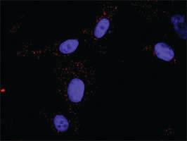 Anti-FLT1 + CRKL Antibody Pair