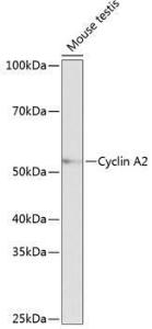 Western blot analysis of extracts of Mouse testis, using Anti-Cyclin A2 Antibody [ARC0359] (A308964) at 1:1,000 dilution