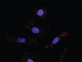 Anti-FLT1 + CRKL Antibody Pair