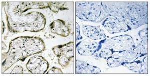 Immunohistochemical analysis of paraffin-embedded human placenta using Anti-MRPS32 Antibody. The right hand panel represents a negative control, where the antibody was pre-incubated with the immunising peptide.