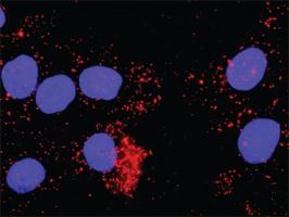 Anti-FLT1 + CRKL Antibody Pair