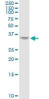 Anti-AKR1C2 Rabbit Polyclonal Antibody