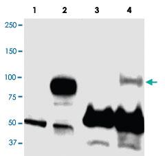 Anti-PRDM1 Rabbit Polyclonal Antibody