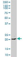 Anti-CCDC126 Mouse Polyclonal Antibody