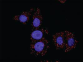 Anti-FLT1 + CRKL Antibody Pair