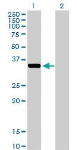 Anti-AKR1C2 Rabbit Polyclonal Antibody