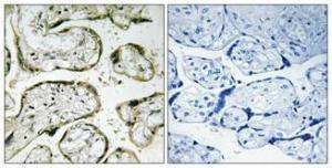 Immunohistochemical analysis of paraffin-embedded human placenta using Anti-MRPS32 Antibody 1:100 (4°C overnight). The right hand panel represents a negative control, where the antibody was pre-incubated with the immunising peptide.