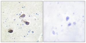 Antibody anti-KOR-1 100 µg