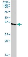 Anti-AKR1C2 Rabbit Polyclonal Antibody