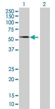 Anti-PYGO2 Mouse Polyclonal Antibody