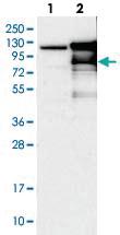 Anti-RAD21 Rabbit Polyclonal Antibody