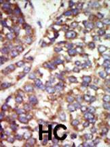 Anti-PAK2 Rabbit Polyclonal Antibody (Biotin)