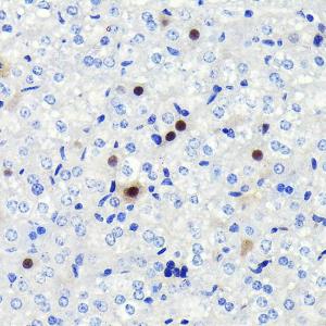 Immunohistochemistry analysis of paraffin-embedded mouse liver using Anti-Cyclin A2 Antibody [ARC0359] (A308964) at a dilution of 1:100 (40X lens). Perform microwave antigen retrieval with 10 mM PBS buffer pH 7.2 before commencing with IHC staining protocol