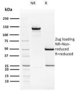 SDS-PAGE analysis of Anti-HPV16 E2 Antibody [TVG 261] under non-reduced and reduced conditions; showing intact IgG and intact heavy and light chains, respectively. SDS-PAGE analysis confirms the integrity and purity of the antibody