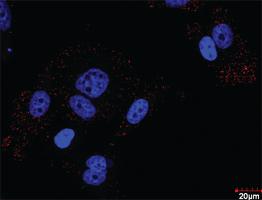 Anti-FLT1 + CRKL Antibody Pair