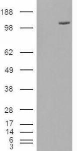 HEK293 overexpressing FAM62A (RC201380) and probed with Anti-FAM62A Antibody (A84466) (mock transfection in first lane), tested by Origene