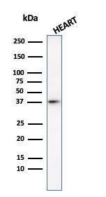 Antibody anti-HISTONE H1 100 µg