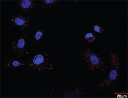 Anti-FLT1 + CRKL Antibody Pair