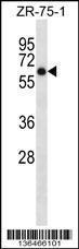 Anti-ARSD Rabbit Polyclonal Antibody (HRP (Horseradish Peroxidase))