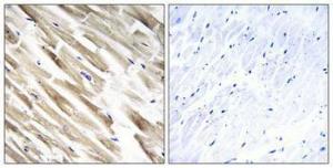 Immunohistochemical analysis of paraffin-embedded human heart using Anti-MRPL33 Antibody 1:100 (4 °C overnight). The right hand panel represents a negative control, where the antibody was pre-incubated with the immunising peptide