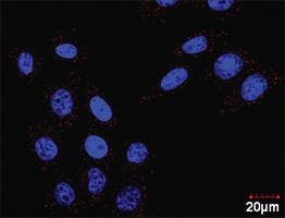 Anti-FLT1 + CRKL Antibody Pair