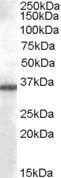 Anti-AKR1B10 Goat Polyclonal Antibody