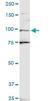 Anti-ZNF598 Mouse Polyclonal Antibody