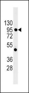 Anti-CDH1 Rabbit Polyclonal Antibody (APC (Allophycocyanin))