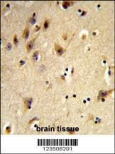 Anti-Histone H2A/s Rabbit Polyclonal Antibody (AP (Alkaline Phosphatase))