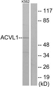 Anti-ACVRL1 Rabbit Polyclonal Antibody