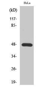 Anti-KCNJ2 antibody