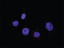 Anti-PDGFRB + CRKL Antibody Pair