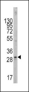 Anti-KITLG Rabbit Polyclonal Antibody (Biotin)