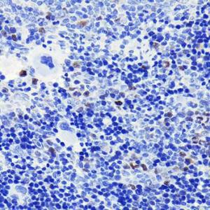 Immunohistochemistry analysis of paraffin-embedded rat spleen using Anti-Cyclin A2 Antibody [ARC0359] (A308964) at a dilution of 1:100 (40X lens). Perform microwave antigen retrieval with 10 mM PBS buffer pH 7.2 before commencing with IHC staining protocol