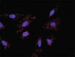 Anti-PDGFRB + CRKL Antibody Pair