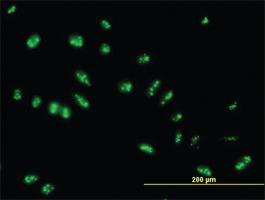 Anti-LYAR Mouse Polyclonal Antibody