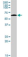 Anti-PLXDC1 Rabbit Polyclonal Antibody