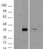 Anti-AKR1B10 Goat Polyclonal Antibody