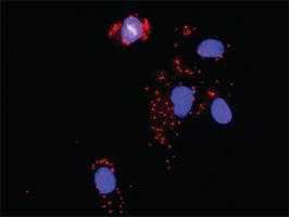 Anti-PDGFRB + CRKL Antibody Pair