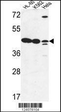 Anti-LFNG Rabbit Polyclonal Antibody (FITC (Fluorescein Isothiocyanate))