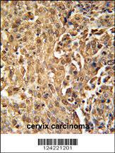 Anti-ZC3HAV1 Rabbit Polyclonal Antibody (FITC (Fluorescein Isothiocyanate))